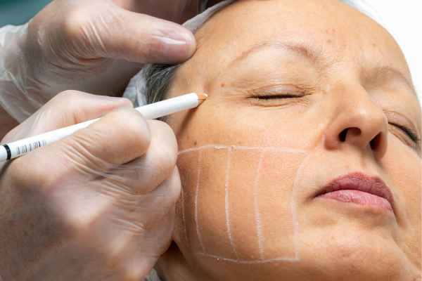 CryoPen: 5 Skin Concerns It May Be Used to Treat 4 What should you ask before having CryoPen treatment Reading?