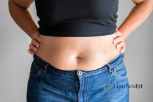 Bidding Farewell to Muffin Tops with Aqualyx Fat Injections 2 Do you wish you could reduce your muffin top Reading With Aqualy fat dissolving injections you can!
