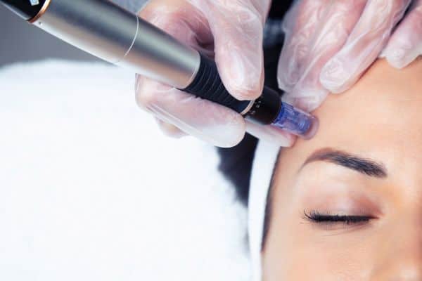 Explaining Total Skin Tightening Treatment and What to Expect 2 What Skin Concerns Can Total Skin Tightening Treatment Help With Reading?
